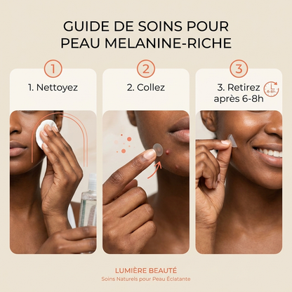 Patch Anti-Boutons Hydrocolloïde HUENCO — Boîte de 36 | Absorbe les Imperfections en 6-8h