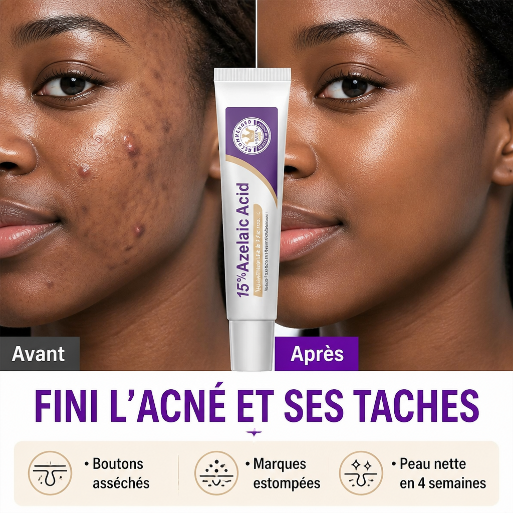 Acide Azélaïque 15% – Crème Anti-Boutons & Anti-Taches (Niacinamide + Vit. C)