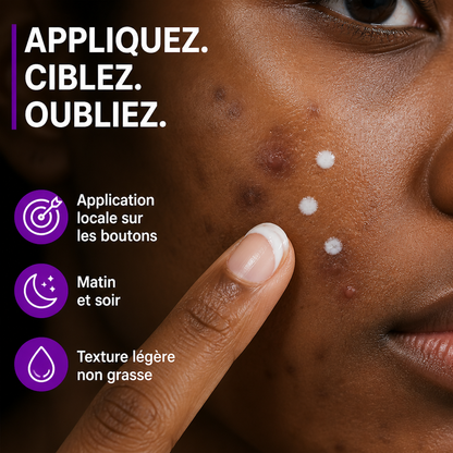 Acide Azélaïque 15% – Crème Anti-Boutons & Anti-Taches (Niacinamide + Vit. C)