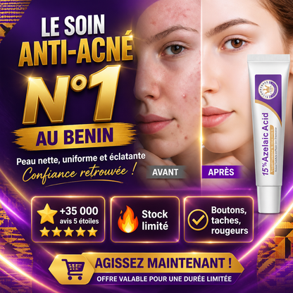 Acide Azélaïque 15% – Crème Anti-Boutons & Anti-Taches (Niacinamide + Vit. C)