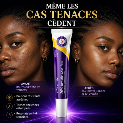 Acide Azélaïque 20% – Concentration Maximale Acné & Taches Résistantes