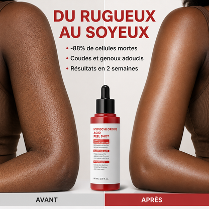 Peel Shot Coréen – Peeling Doux Visage & Corps à l'Acide Hypochloreux 80ml
